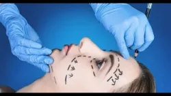 Природна красота: защо все повече дами са подвластни на модата на козметичните корекции, 100% будни