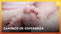 Madres de niños con síndrome de Angelman: Dos historias de vida