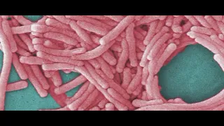Outbreak of Legionnaires' disease hits Upper East Side of Manhattan