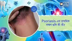 Psoriasis এর প্রাথমিক লক্ষণ গুলি কী কী। Health and Wellness