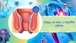 Piles এর কারণ ও আয়ুর্বেদিক প্রতিকার। Health and Wellness