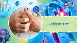 একজিমার কারণ। Health and Wellness